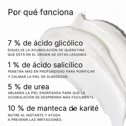 Por qué funciona: ácido glicólico, salicílico, urea, manteca de karité