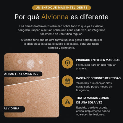 Por qué Alvionna es diferente