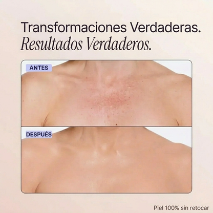 Perfeccionador de cobertura corporal