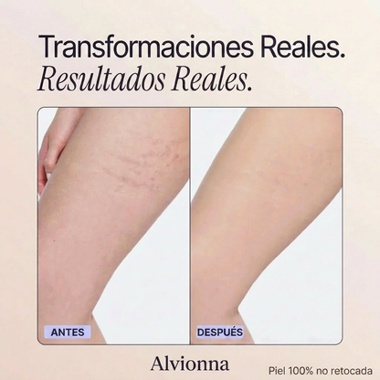 Perfeccionador de cobertura corporal