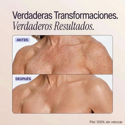 Perfeccionador de cobertura corporal