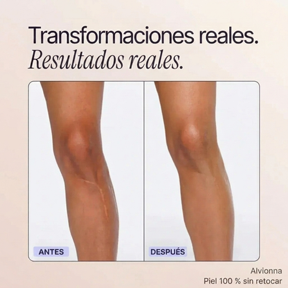 Perfeccionador de cobertura corporal