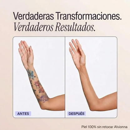 Perfeccionador de cobertura corporal