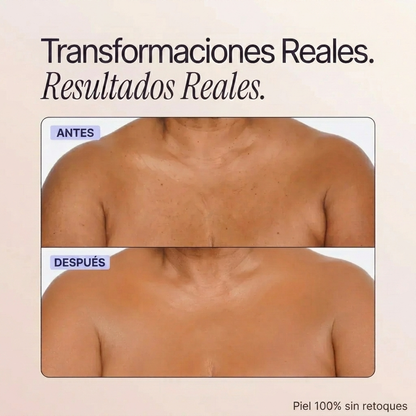 Perfeccionador de cobertura corporal