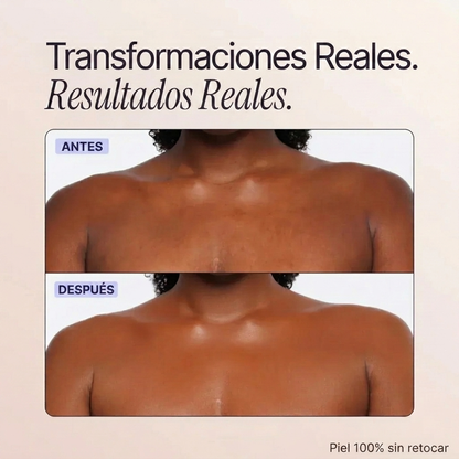 Perfeccionador de cobertura corporal