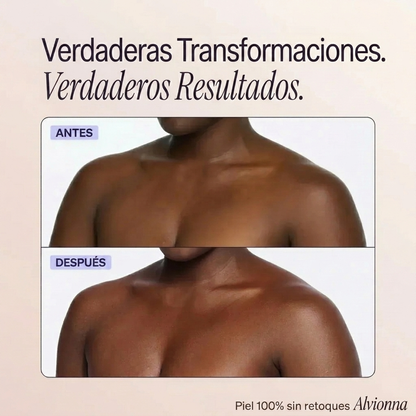 Perfeccionador de cobertura corporal